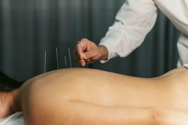 Klinik Akupunktur
