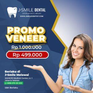 Promo Veneer