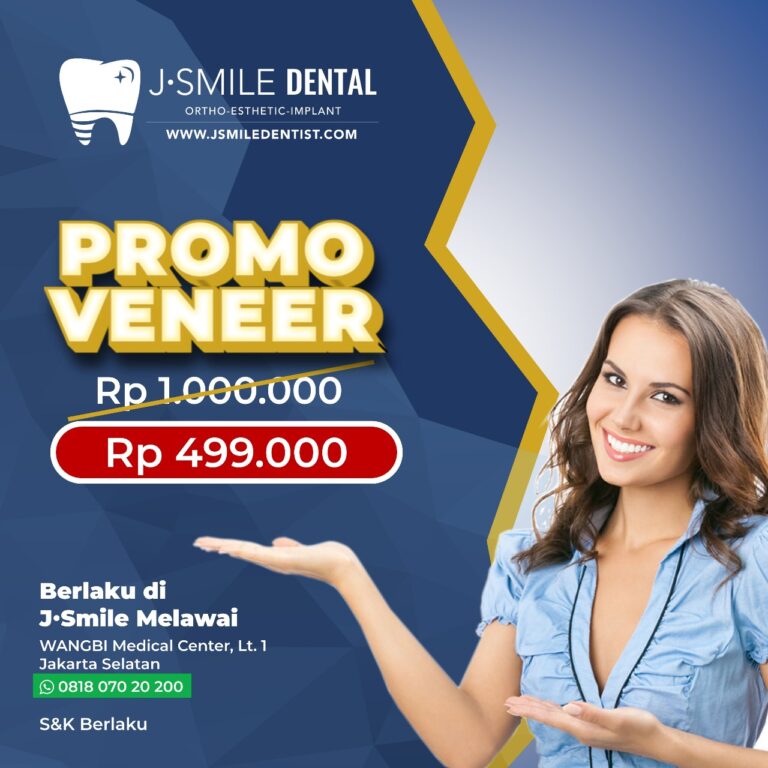 Promo Veneer