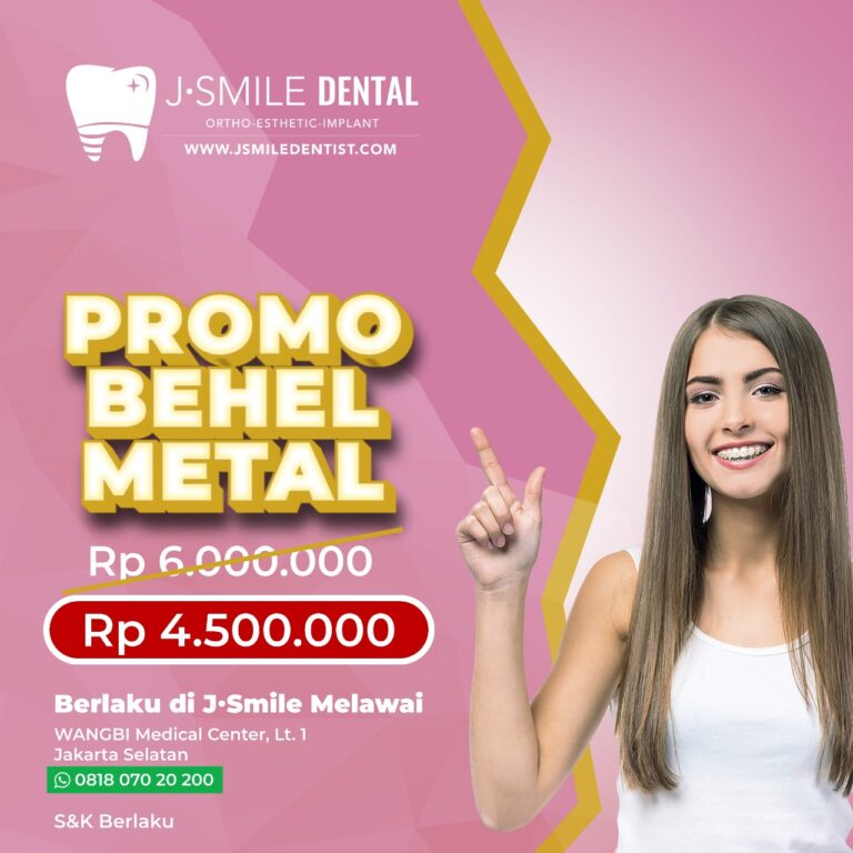 Promo Behel Metal