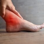Asam Urat Bisa Dikendalikan Tanpa Obat? Cari Tahu Caranya di Sini!