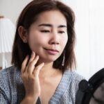 Akupunktur untuk Bell’s Palsy: Membantu Pemulihan Kelumpuhan Wajah Secara Medis