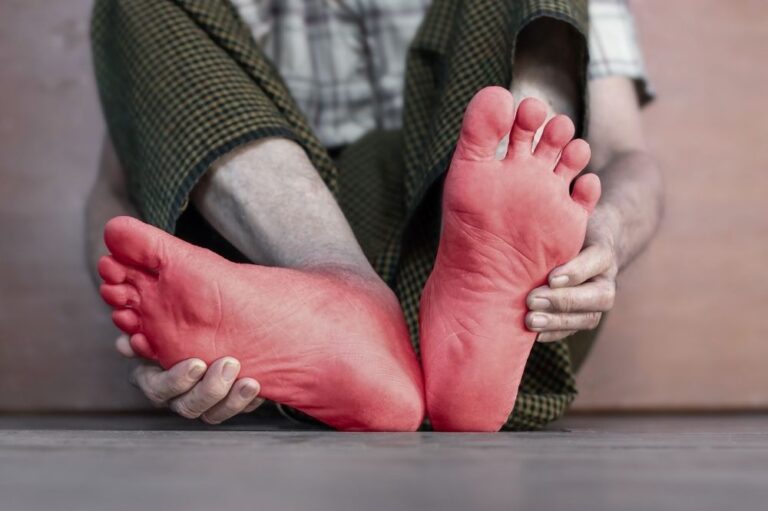 Akupunktur untuk Neuropati Diabetik