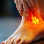 Akupunktur untuk Peradangan Kronis | Terapi Pendukung di Klinik Wangbi