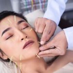berapa kali akupunktur facelift terlihat hasilnya