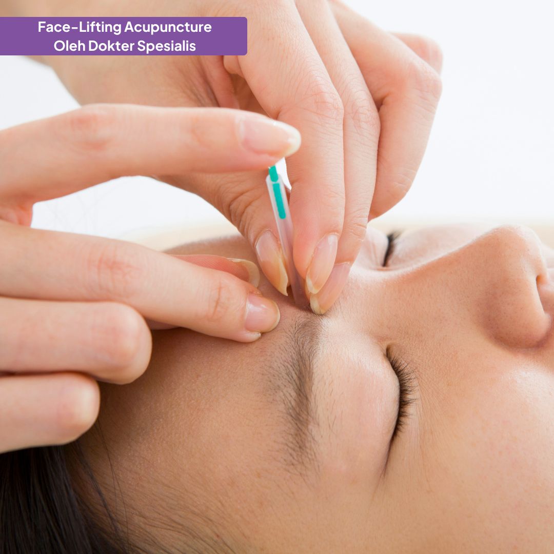 Face-Lifting Acupuncture oleh Dokter Spesialis