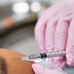 Manfaat Botox Wajah: Mengurangi Kerutan Wajah | Wangbi Clinic