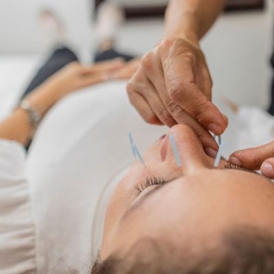 Manfaat Akupunktur Wajah